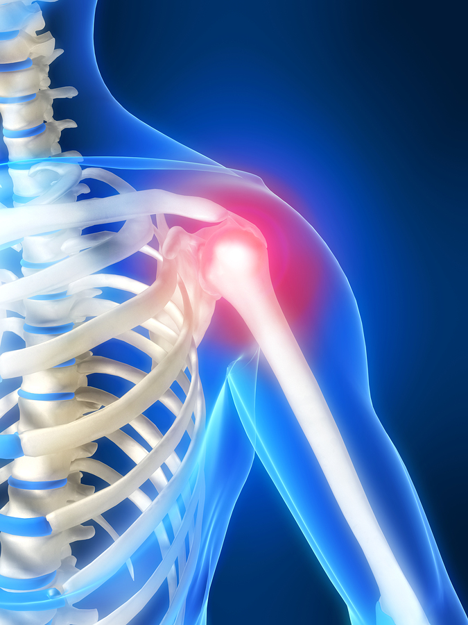 What is a frozen shoulder and how is it treated